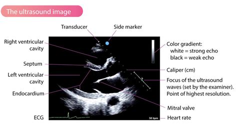 2d echo interpretation|All You Need to Know: How to Read the 2D Echo Test Result.